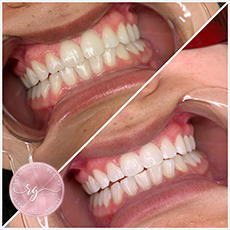 Royal Glow Aesthetics